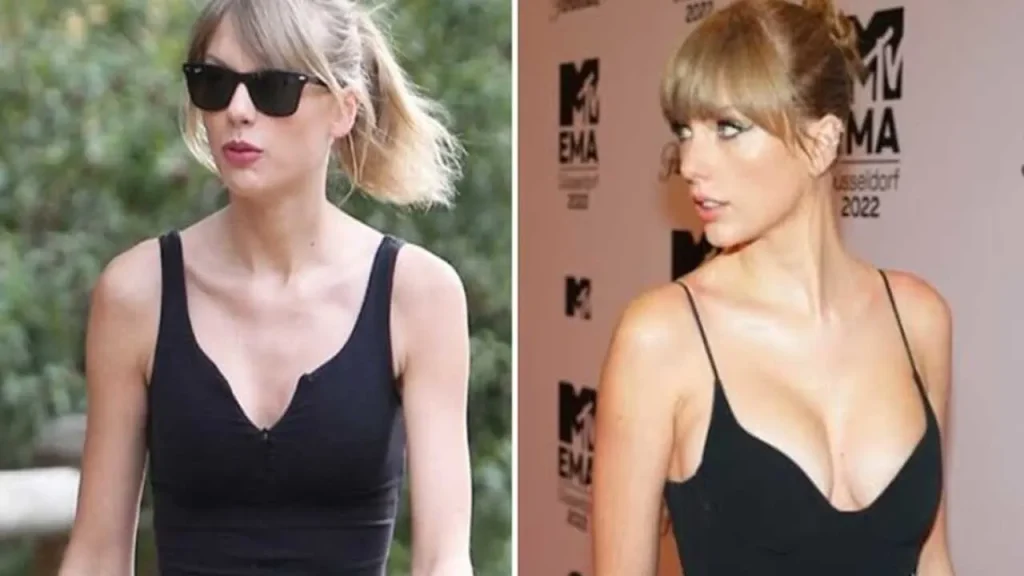 Breast Augmentation Claims